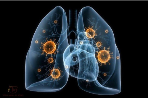 Triệu chứng lâm sàng bệnh lao phổi