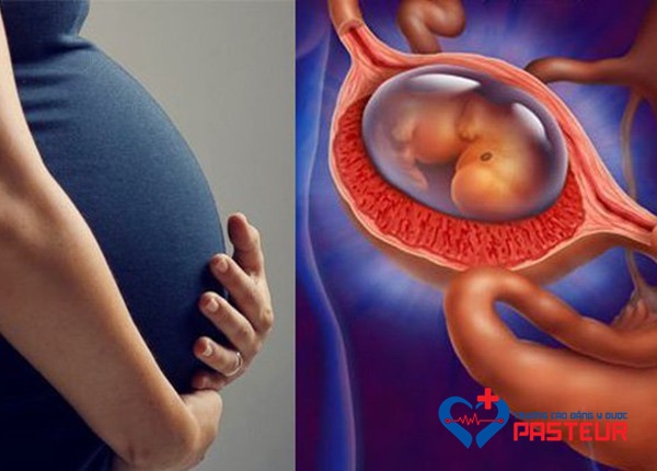 Tìm hiểu về bệnh chửa ngoài tử cung ở sản phụ